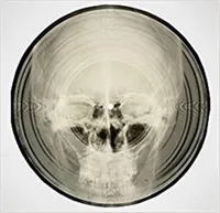 Bone Music: Soviet X-Ray Audio /anglais