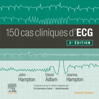 150 cas cliniques d'ECG