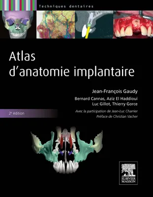 Atlas d'anatomie implantaire, Pilon Partiel 400ex 19/12/14