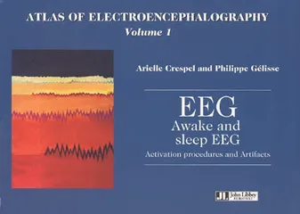 Atlas of electroencephalography, 1, Awake and sleep EEG activation procedures and artifacts, activation procedures and artifacts