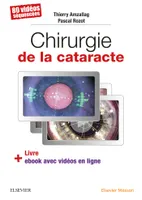 Chirurgie de la cataracte, 60 Videos Sequencees