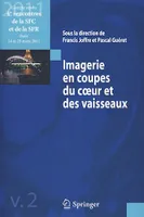 Imagerie en coupes du coeur et des vaisseaux, (Compte rendu 4es rencontres de la SFC et de la SFR Paris 24 et 25 mars 2011)