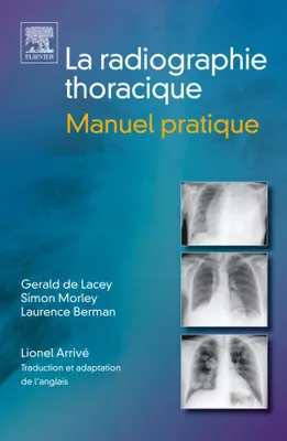 La radiographie thoracique. Manuel pratique, manuel pratique