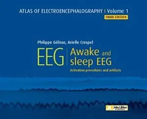 EEG : Awake and Sleep, Activation Procedures and Artifacts