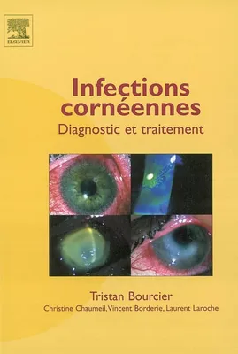 Infections cornéennes, diagnostic et traitement