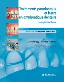 Traitements parodontaux et lasers en omnipratique dentaire, La simplicité efficace
