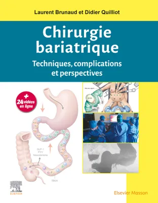 Chirurgie bariatrique, Techniques, complications et perspectives