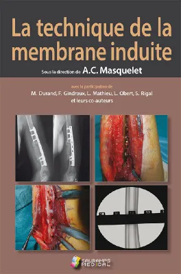 La technique de la membrane induite, Principes, pratiques et perspectives