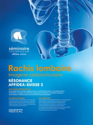 Rachis lombaire - Imagerie ostéoarticulaire: Résonance Affidea - Suisse 3, RESONANCE- AFFIDEA SUISSE 3