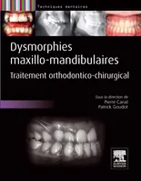 Dysmorphies maxillo-mandibulaires, Traitement orthodontico-chirurgical